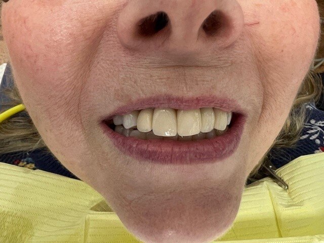 Meadow Brook Dental - Gallery Image